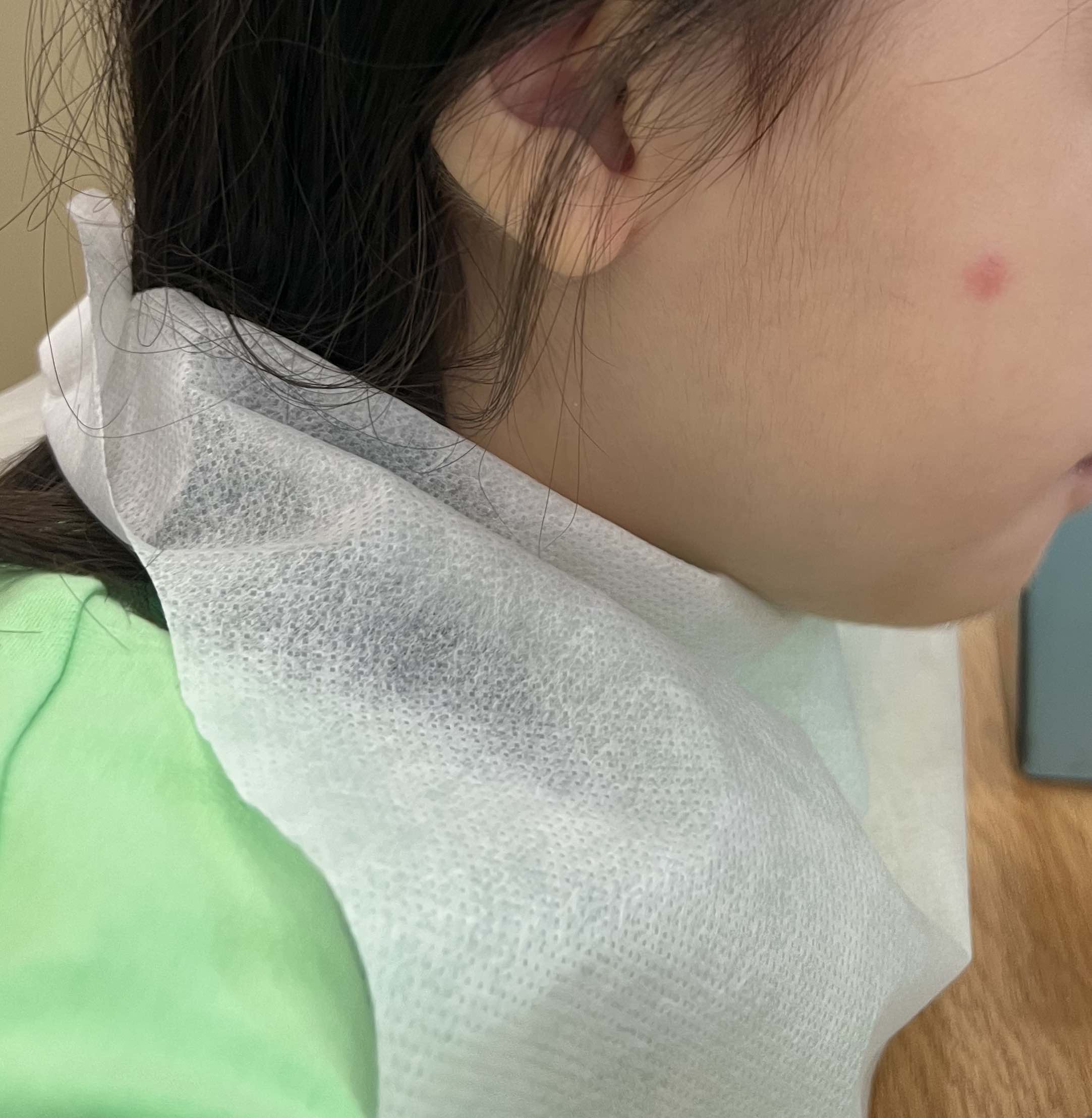 얼굴에 벌레 물린 자국이 있는 아기의 옆모습